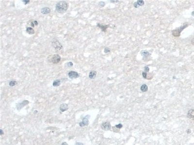 Polyclonal Antibody to Barrier To Autointegration Factor 1 (BANF1)
