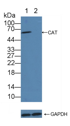 Polyclonal Antibody to Catalase (CAT)