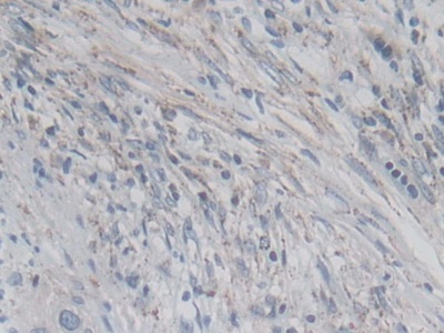 Polyclonal Antibody to Drebrin 1 (DBN1)