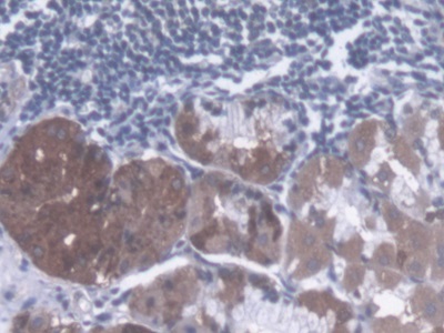 Polyclonal Antibody to Dystonin (DST)