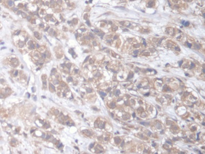 Polyclonal Antibody to Engulfment And Cell Motility 2 (ELMO2)