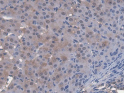 Polyclonal Antibody to Cytosolic Ovarian Carcinoma Antigen 1 (COVA1)