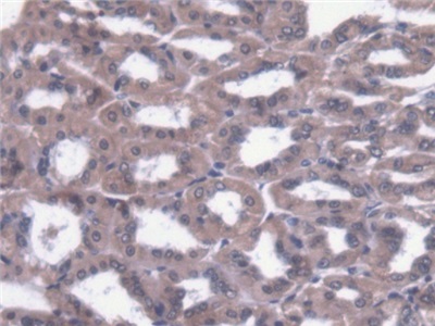 Polyclonal Antibody to Cytosolic Ovarian Carcinoma Antigen 1 (COVA1)