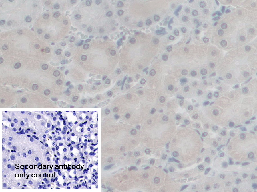 Polyclonal Antibody to G-Elongation Factor, Mitochondrial 1 (GFM1)