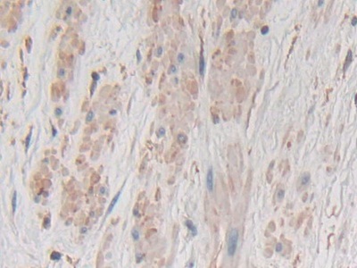 Polyclonal Antibody to Gastrokine 1 (GKN1)