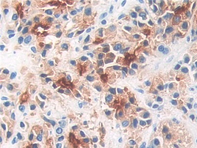 Polyclonal Antibody to Prostate-specific Membrane Antigen (PMSA)