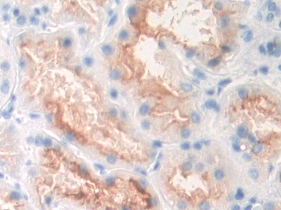 Polyclonal Antibody to Prostate-specific Membrane Antigen (PMSA)