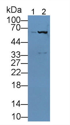 Polyclonal Antibody to Hyaluronan Synthase 1 (HAS1)