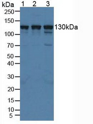 Polyclonal Antibody to Huntingtin Interacting Protein 1 Related Protein (HIP1R)