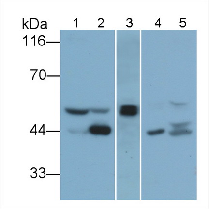 Polyclonal Antibody to Islet Cell Autoantigen 1 (ICA1)