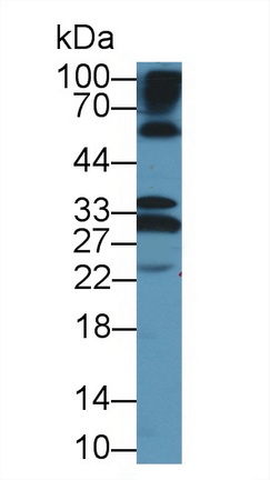 Polyclonal Antibody to Keratocan (KERA)
