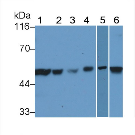 Polyclonal Antibody to X-linked Inhibitor Of Apoptosis Protein (XIAP)