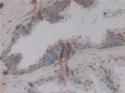 Polyclonal Antibody to Microfibrillar Associated Protein 2 (MFAP2)