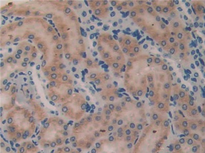 Polyclonal Antibody to Microfibrillar Associated Protein 2 (MFAP2)