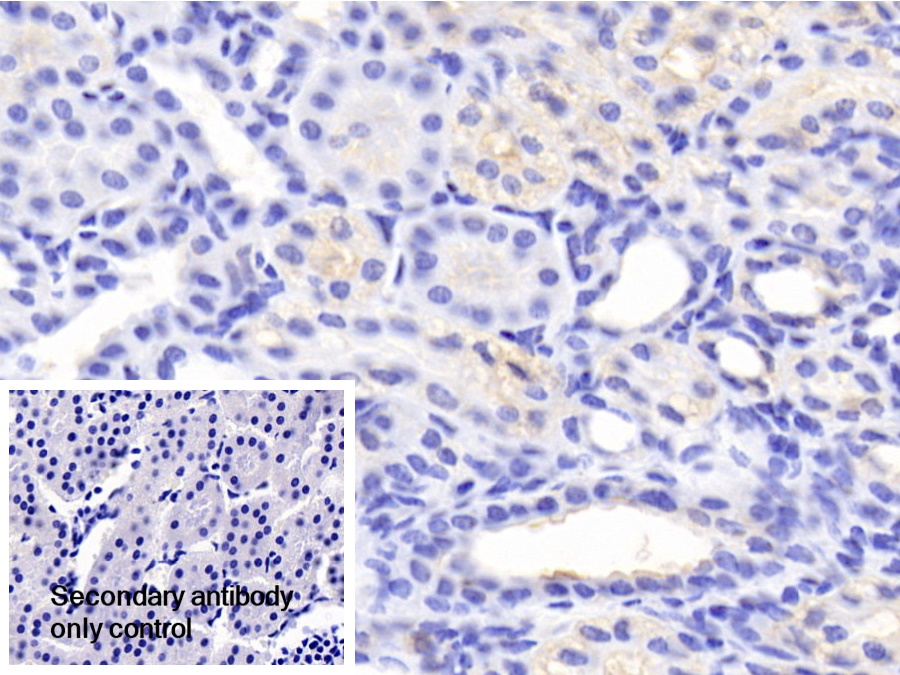 Polyclonal Antibody to Mitofusin 1 (MFN1)
