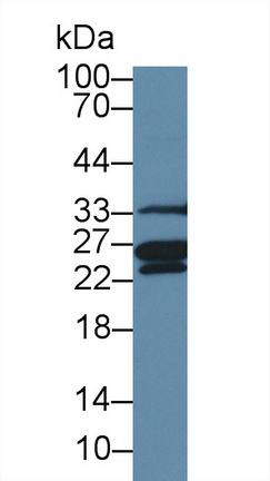 Polyclonal Antibody to Methionine Sulfoxide Reductase A (MSRA)