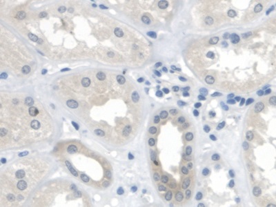 Polyclonal Antibody to Mitochondrial Tumor Suppressor 1 (MTUS1)