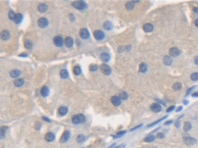 Polyclonal Antibody to N-Ethylmaleimide Sensitive Factor (NSF)