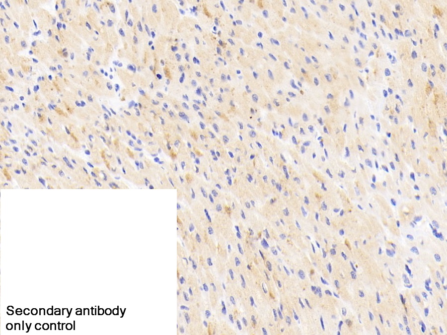Polyclonal Antibody to Neuro Oncological Ventral Antigen 1 (NOVA1)