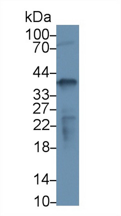 Polyclonal Antibody to Nucleophosmin 1 (NPM1)