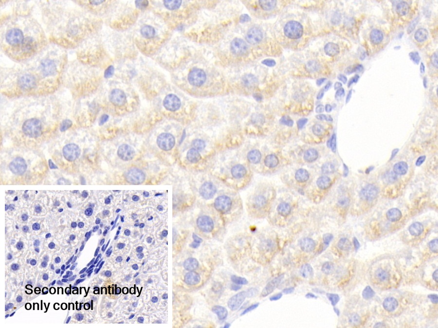 Polyclonal Antibody to Periphilin 1 (PPHLN1)