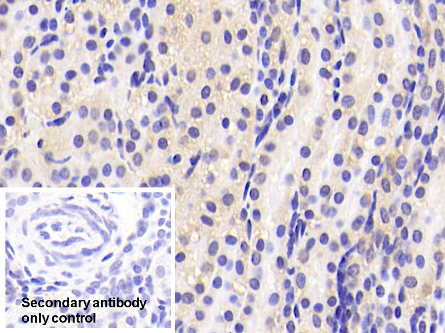 Polyclonal Antibody to Ribophorin I (RPN1)
