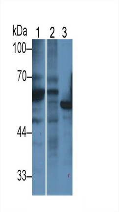 Polyclonal Antibody to Rhotekin (RTKN)