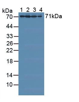 Polyclonal Antibody to Radixin (RDX)