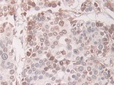 Polyclonal Antibody to Transgelin (TAGLN)
