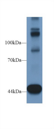 Polyclonal Antibody to Tensin 1 (TNS1)