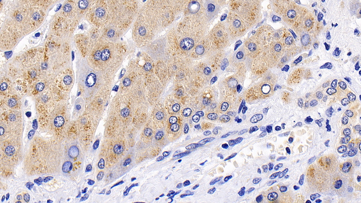 Polyclonal Antibody to Tuberous Sclerosis Protein 1 (TSC1)