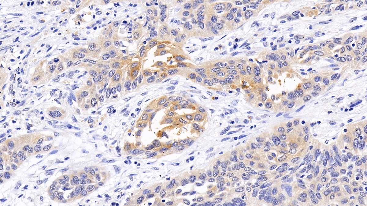 Polyclonal Antibody to Tuberous Sclerosis Protein 1 (TSC1)