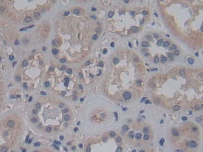 Polyclonal Antibody to Fibroblast Growth Factor 12 (FGF12)