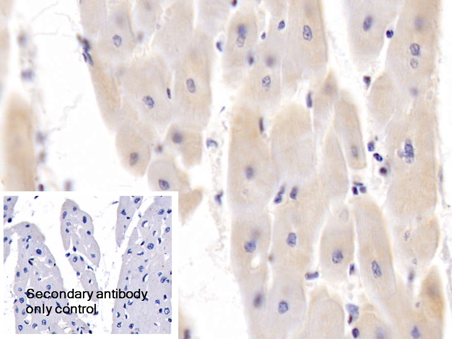 Polyclonal Antibody to Platelet Derived Growth Factor Subunit B (PDGFB)
