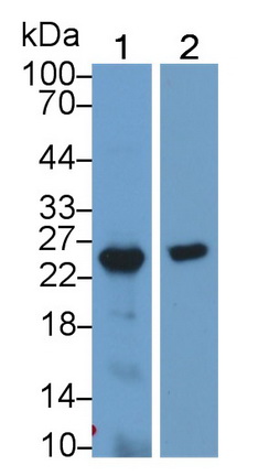 Polyclonal Antibody to Growth Hormone 2 (GH2)