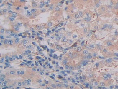Polyclonal Antibody to Cathepsin C (CTSC)