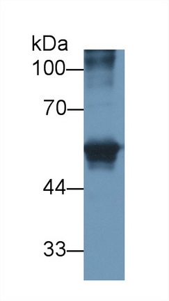 Polyclonal Antibody to Carcinoembryonic Antigen Related Cell Adhesion Molecule 1 (CEACAM1)