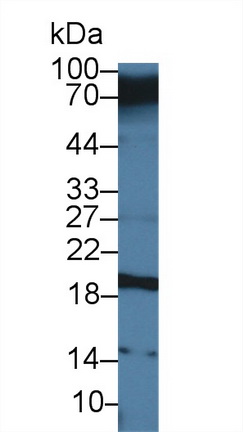 Polyclonal Antibody to Carcinoembryonic Antigen Related Cell Adhesion Molecule 7 (CEACAM7)