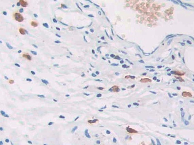 Polyclonal Antibody to Carcinoembryonic Antigen Related Cell Adhesion Molecule 7 (CEACAM7)