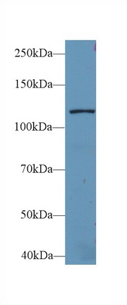 Polyclonal Antibody to Leucyl tRNA Synthetase (LARS)
