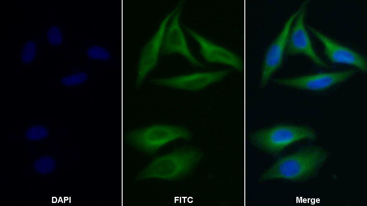 Polyclonal Antibody to Phenylalanyl tRNA Synthetase 2, Mitochondrial (FARS2)
