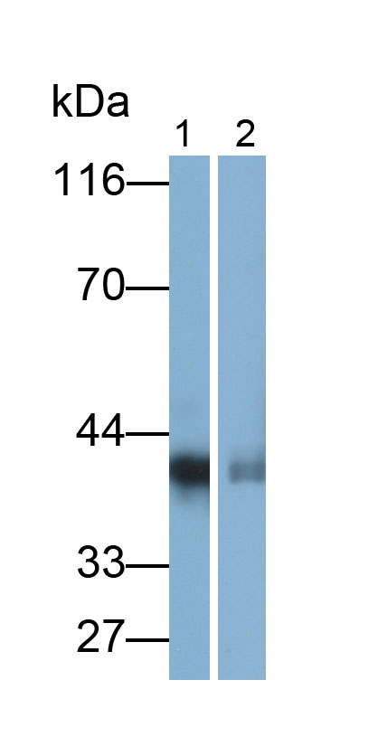Polyclonal Antibody to Carbonic Anhydrase VI (CA6)