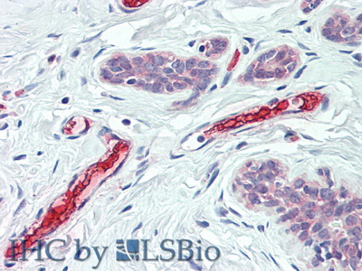 Polyclonal Antibody to Hemoglobin Beta (HBb)