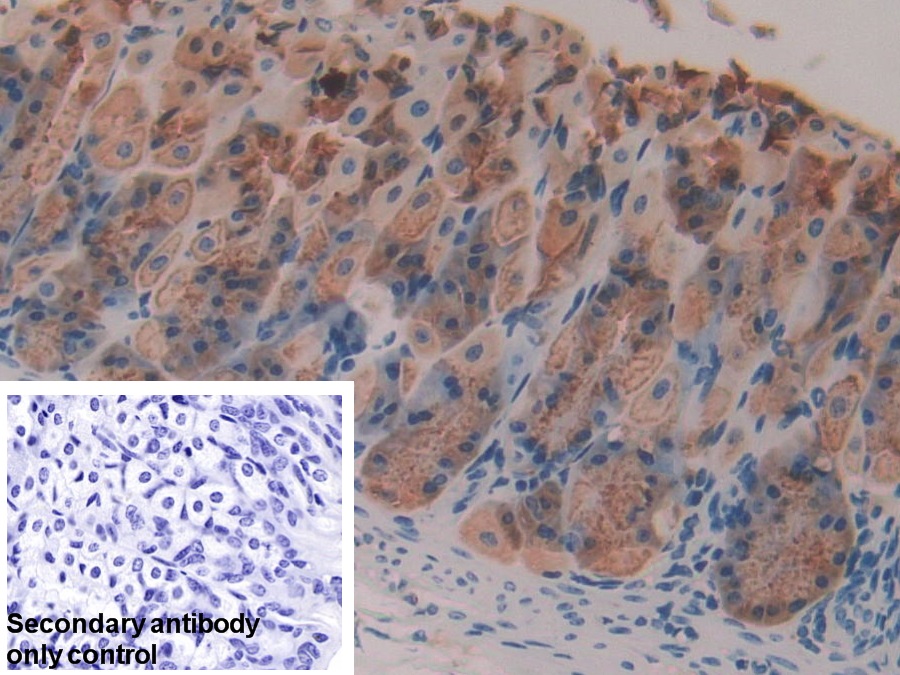 Polyclonal Antibody to Gastric Intrinsic Factor (GIF)