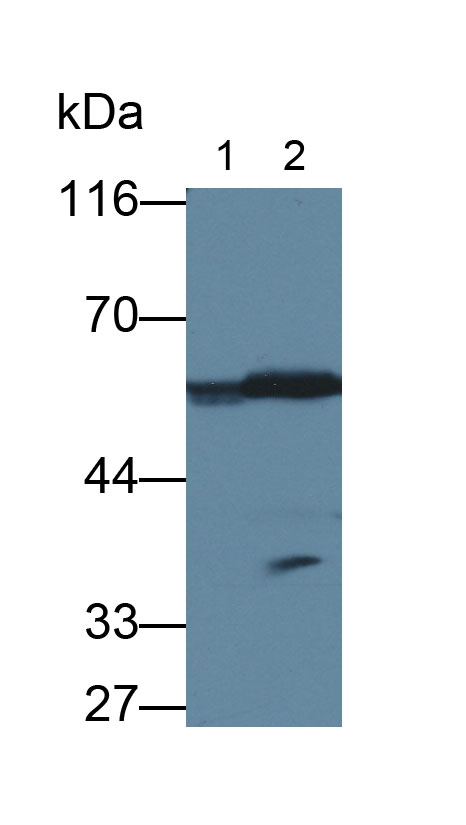 Polyclonal Antibody to Gastric Intrinsic Factor (GIF)