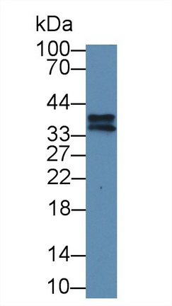 Polyclonal Antibody to Ribonuclease H2 Subunit A (RNASEH2A)