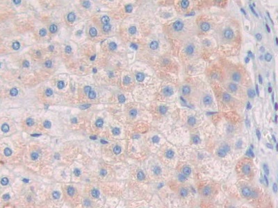 Polyclonal Antibody to Ribonuclease A8 (RNASE8)