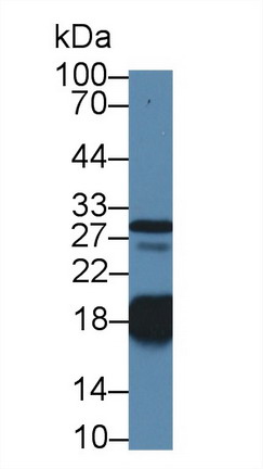 Polyclonal Antibody to Troponin C Type 1, Slow (TNNC1)