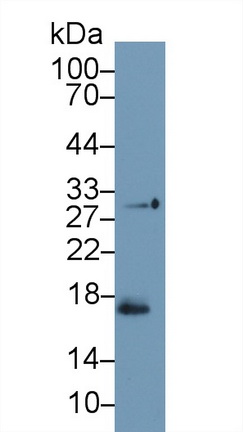 Polyclonal Antibody to Troponin C Type 1, Slow (TNNC1)