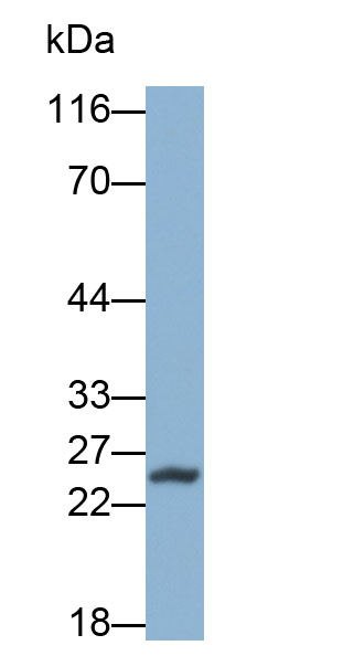 Polyclonal Antibody to Troponin T Type 3, Fast Skeletal (TNNT3)